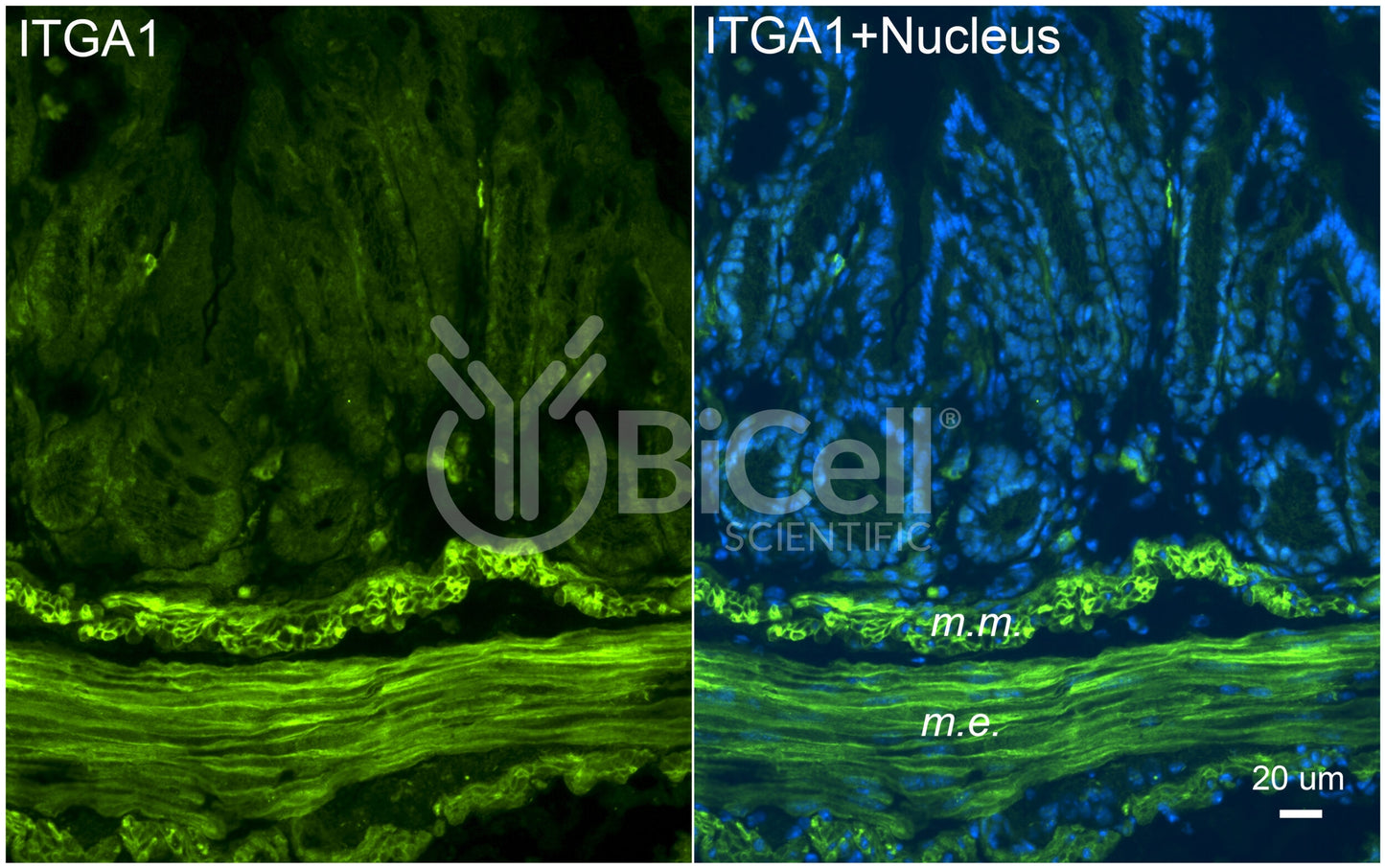 Integrin alpha-1 (ITGA1 or CD49a) Antibody - FFPE Validated