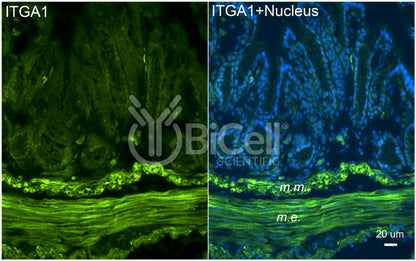 Integrin alpha-1 (ITGA1 or CD49a) Antibody - FFPE Validated