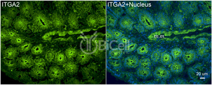 Integrin alpha-2 (ITGA2 or CD49b) Antibody - FFPE Validated