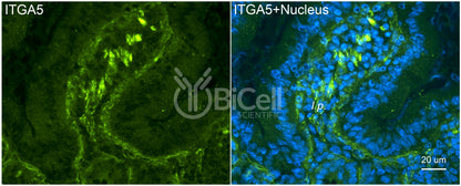 Integrin alpha-5 (ITGA5 or CD49e) Antibody - FFPE Validated