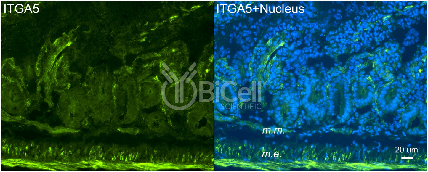 Integrin alpha-5 (ITGA5 or CD49e) Antibody - FFPE Validated