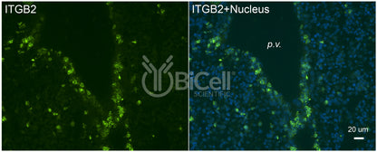 Integrin beta-2 (ITGB2 or CD18) Antibody
