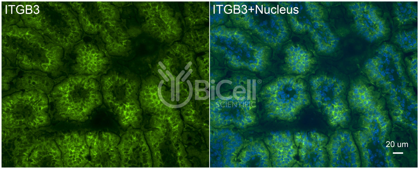 Integrin beta-3 (ITGB3 or CD61) Antibody - FFPE Validated