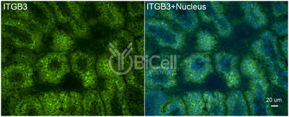 Integrin beta-3 (ITGB3 or CD61) Antibody - FFPE Validated