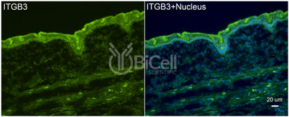 Integrin beta-3 (ITGB3 or CD61) Antibody - Western Blot Validated