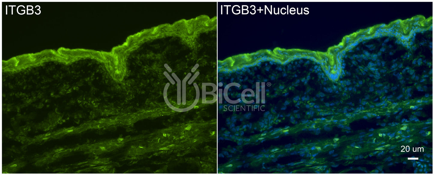 Integrin beta-3 (ITGB3 or CD61) Antibody - FFPE Validated