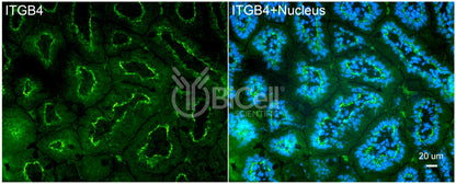 Integrin beta-4 (ITGB4 or CD104) Antibody