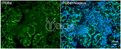 Integrin beta-4 (ITGB4 or CD104) Antibody