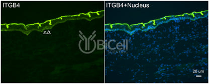 Integrin beta-4 (ITGB4 or CD104) Antibody - FFPE Validated