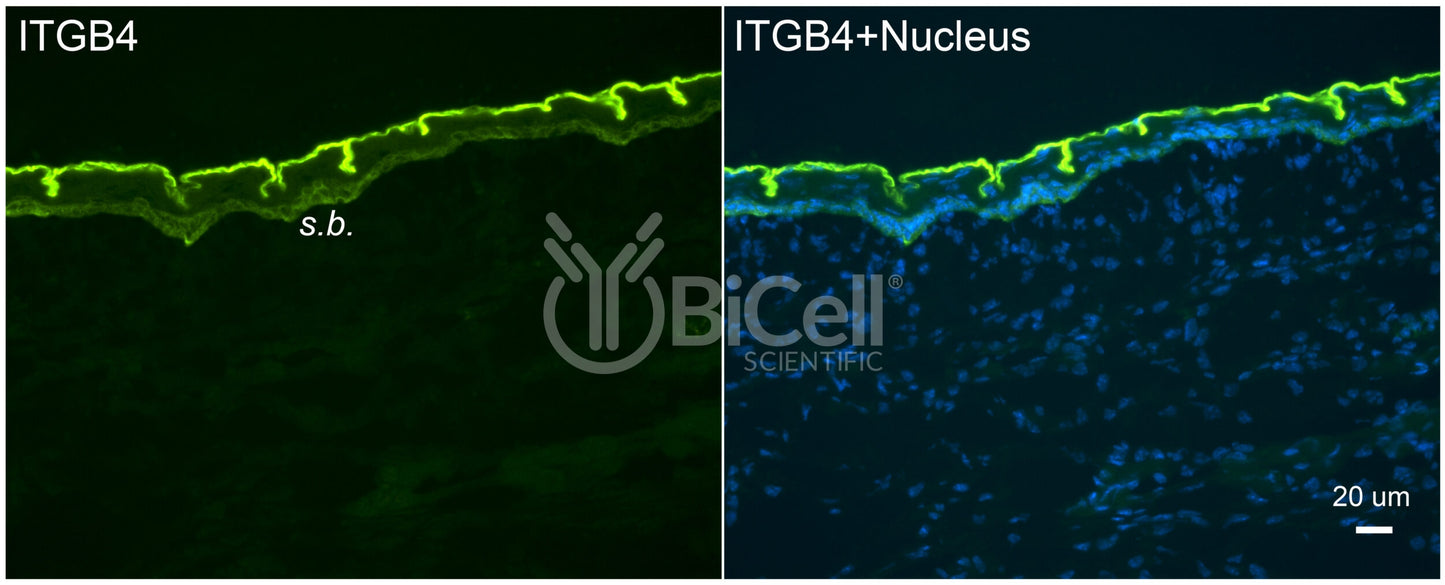 Integrin beta-4 (ITGB4 or CD104) Antibody