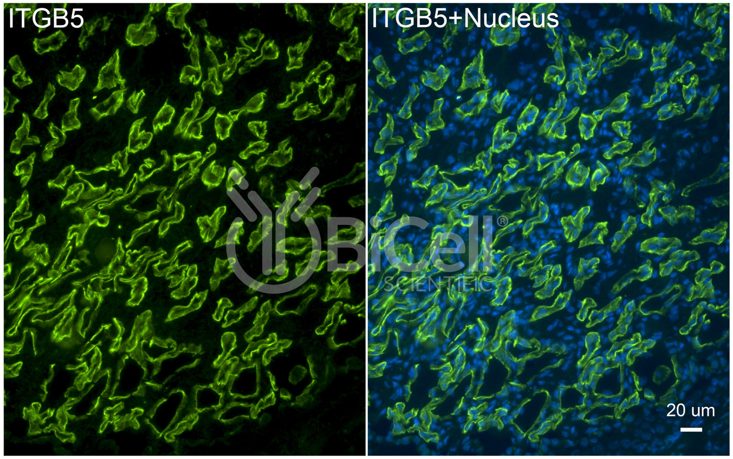 Integrin beta-5 (ITGB5) Antibody - FFPE Validated