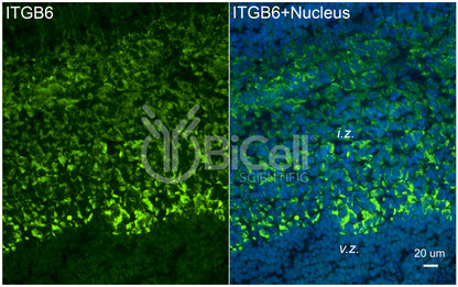 Integrin beta-6 (ITGB6) Antibody - Western Blot Validated
