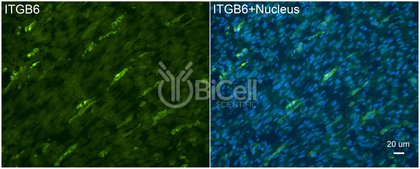 Integrin beta-6 (ITGB6) Antibody - Western Blot Validated