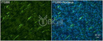 Integrin beta-6 (ITGB6) Antibody - Western Blot Validated