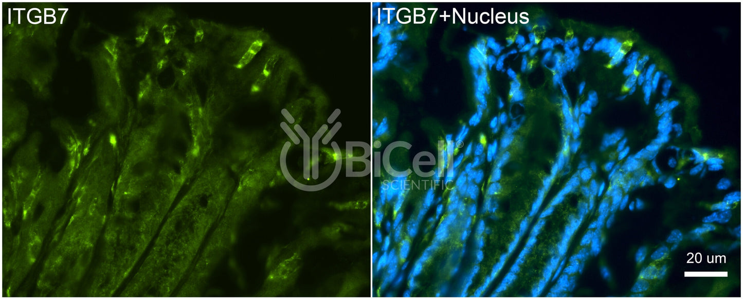 Integrin beta-7 (ITGB7) Antibody - FFPE Validated