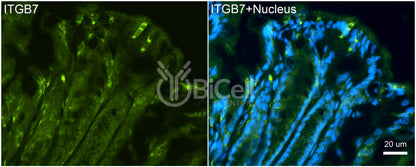 Integrin beta-7 (ITGB7) Antibody - FFPE Validated