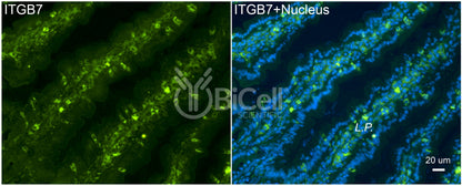 Integrin beta-7 (ITGB7) Antibody - FFPE Validated