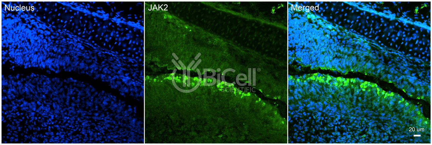 JAK2 (JTK10) Antibody - FFPE Validated