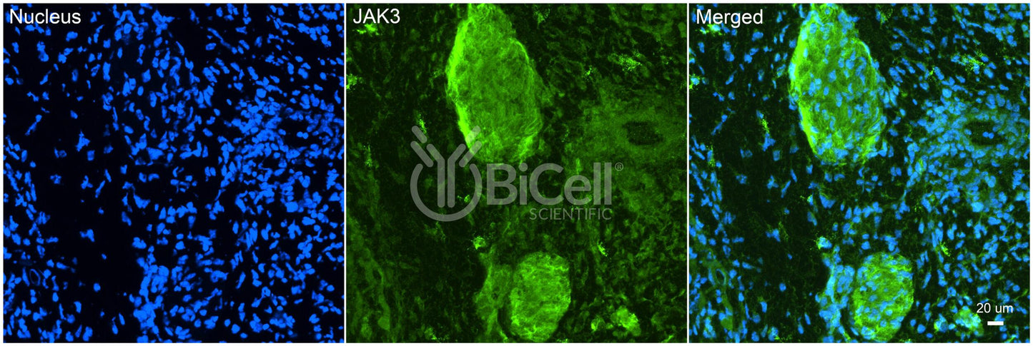 JAK3 (JAKL) Antibody - Western Blot Validated