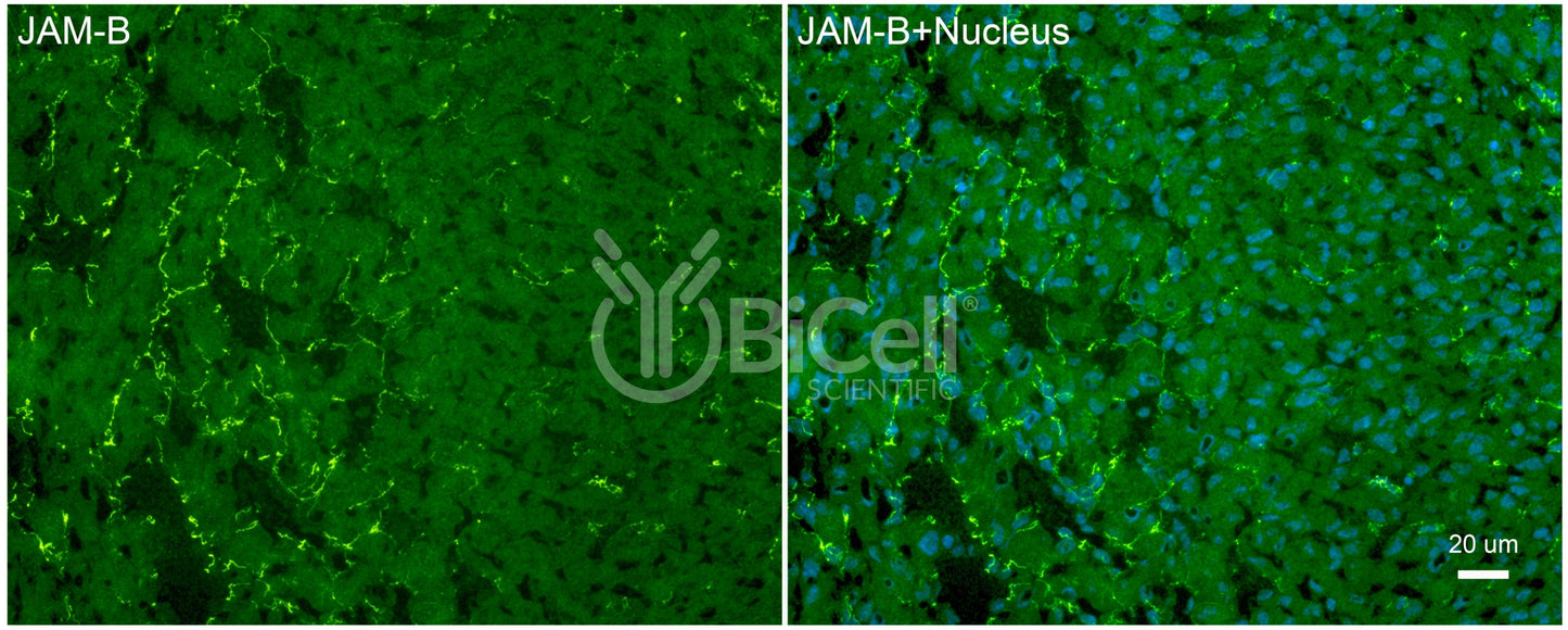 JAM-B (JAM2 or CD322) Antibody - FFPE Validated