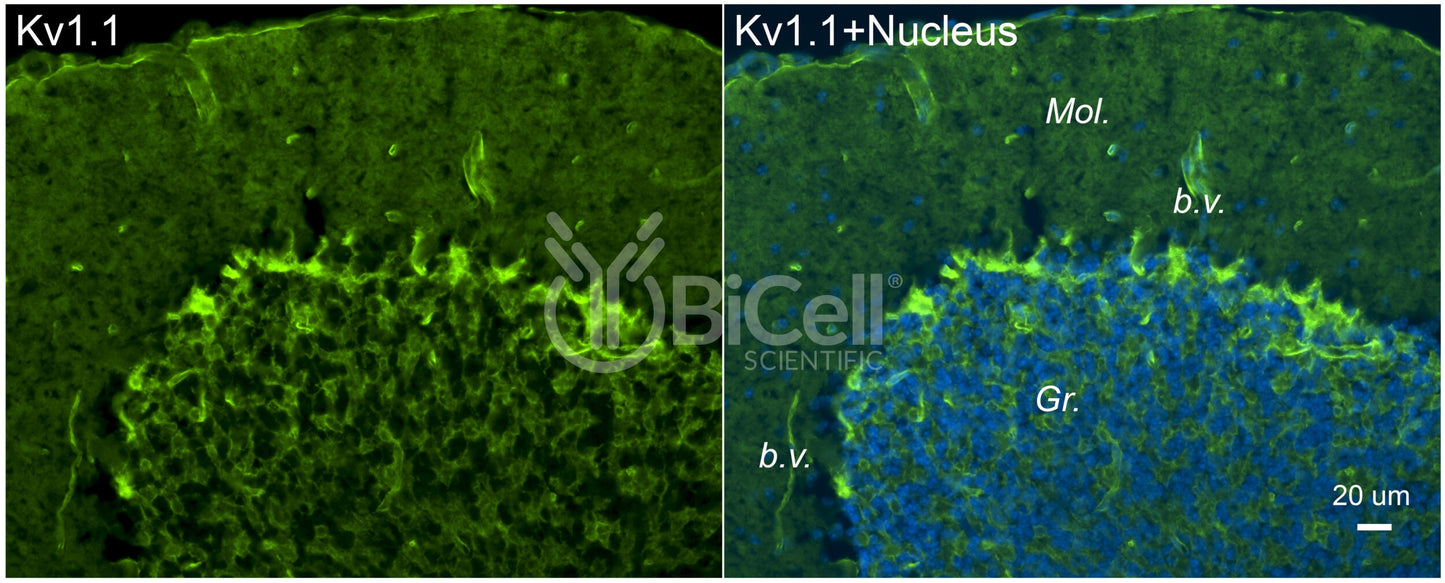 KCNA1 (Kv1.1) Antibody - Western Blot Validated
