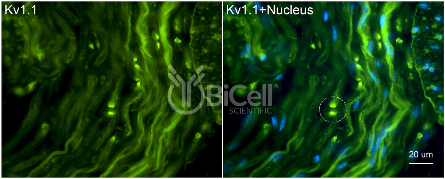 KCNA1 (Kv1.1) Antibody - Western Blot Validated