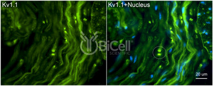 KCNA1 (Kv1.1) Antibody - Western Blot Validated