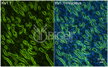 KCNA1 (Kv1.1) Antibody - Western Blot Validated