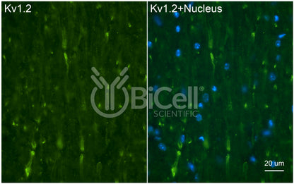 KCNA2 (Kv1.2) Antibody - Western Blot Validated