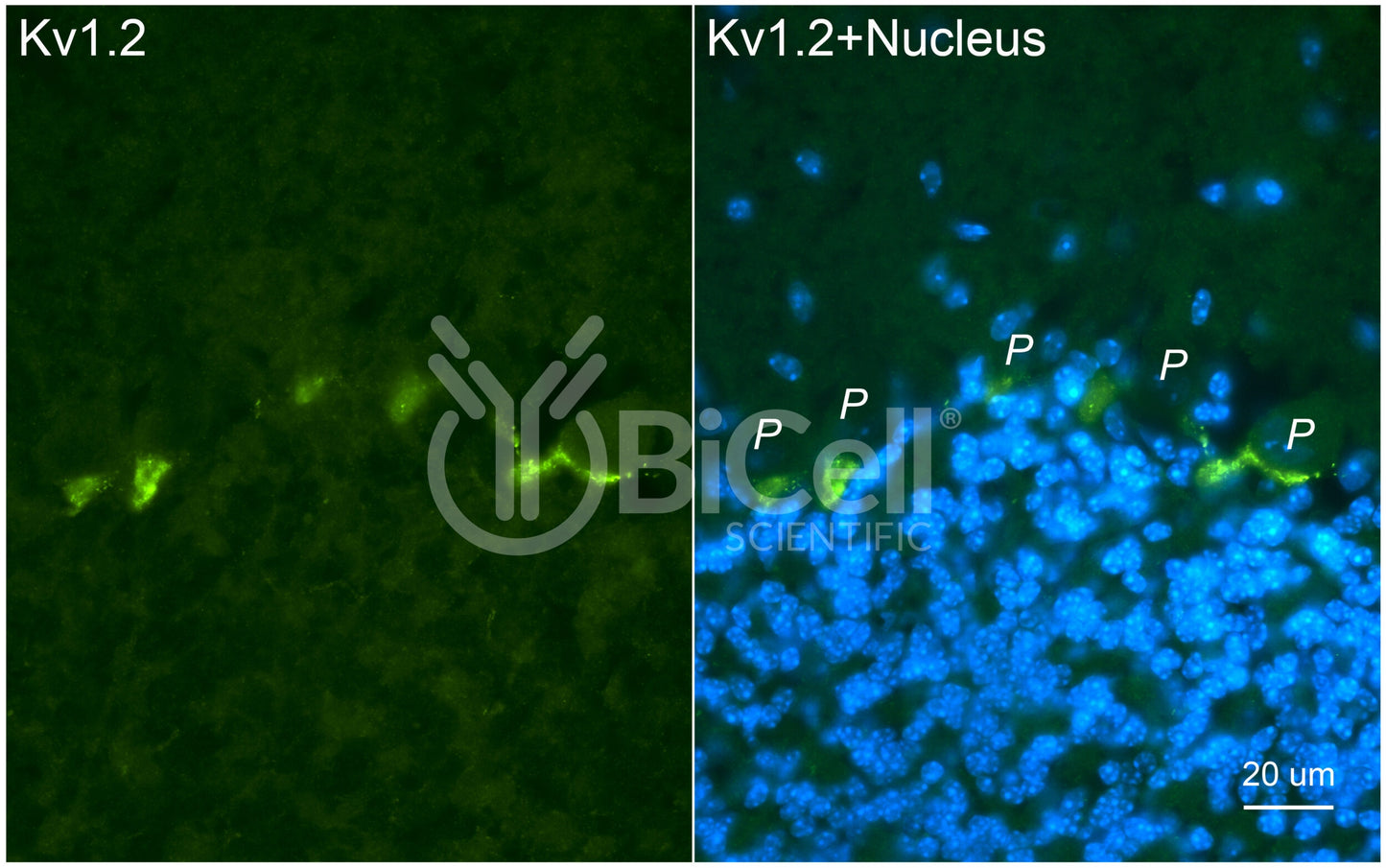 KCNA2 (Kv1.2) Antibody - FFPE Validated