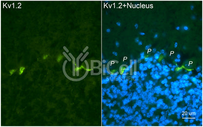 KCNA2 (Kv1.2) Antibody - FFPE Validated