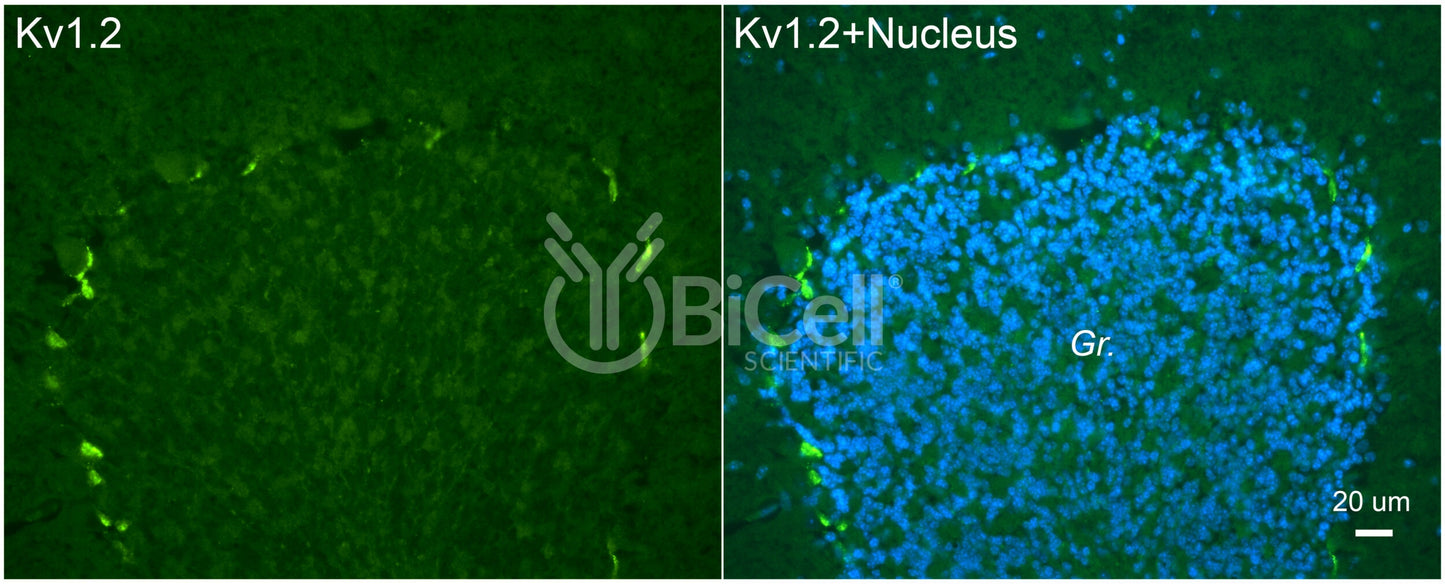 KCNA2 (Kv1.2) Antibody - FFPE Validated
