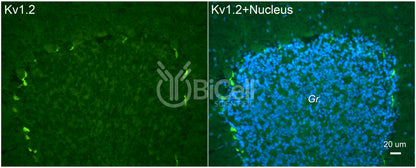 KCNA2 (Kv1.2) Antibody - FFPE Validated