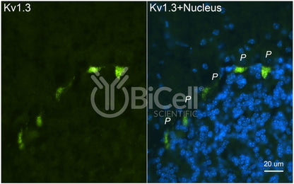 KCNA3 (Kv1.3) Antibody - FFPE Validated