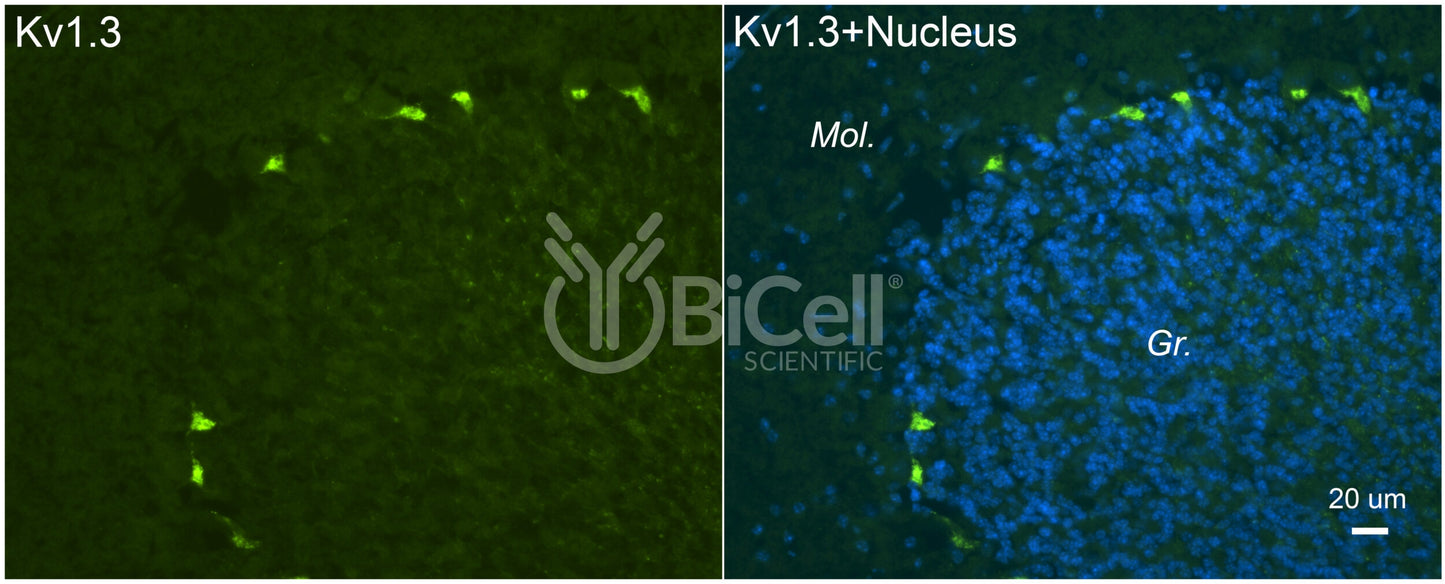 KCNA3 (Kv1.3) Antibody - FFPE Validated