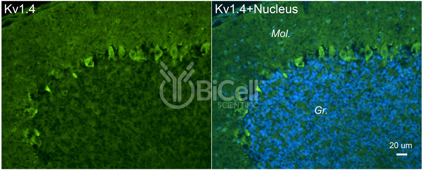 KCNA4 (Kv1.4) Antibody - Western Blot Validated