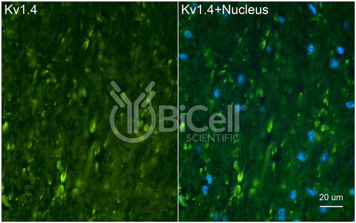 KCNA4 (Kv1.4) Antibody - FFPE Validated