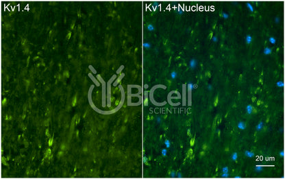 KCNA4 (Kv1.4) Antibody