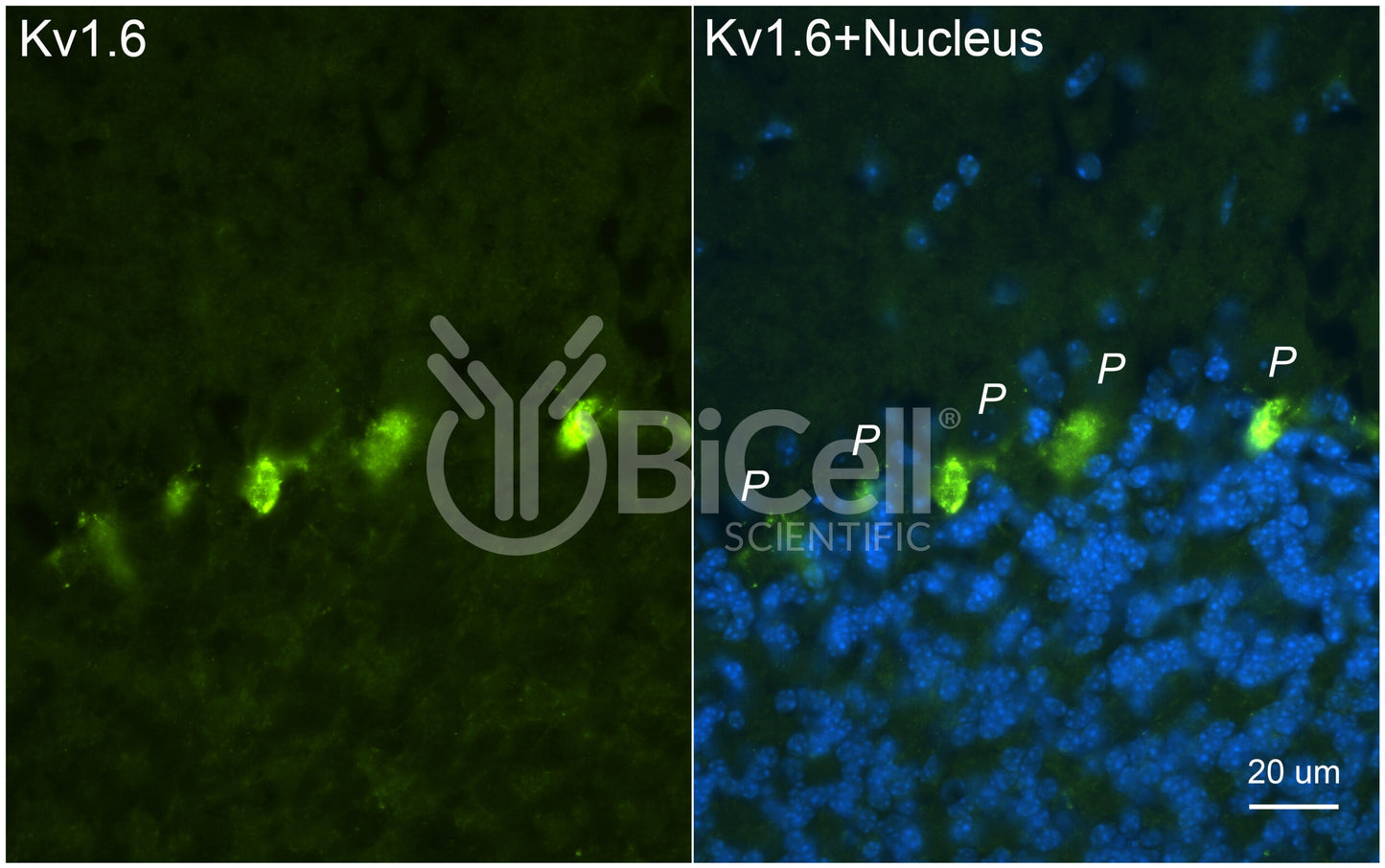 KCNA6 (Kv1.6) Antibody - Western Blot Validated
