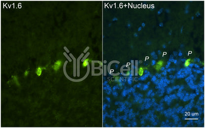 KCNA6 (Kv1.6) Antibody - Western Blot Validated