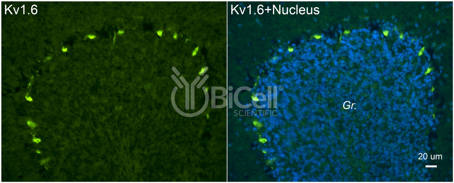 KCNA6 (Kv1.6) Antibody - Western Blot Validated