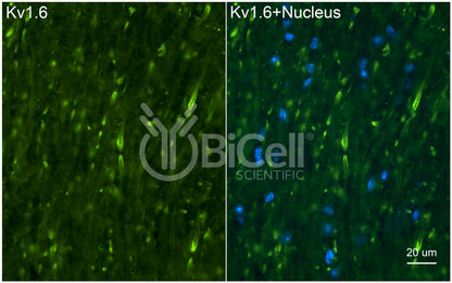 KCNA6 (Kv1.6) Antibody