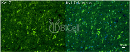 KCNA7 (Kv1.7) Antibody - Western Blot Validated