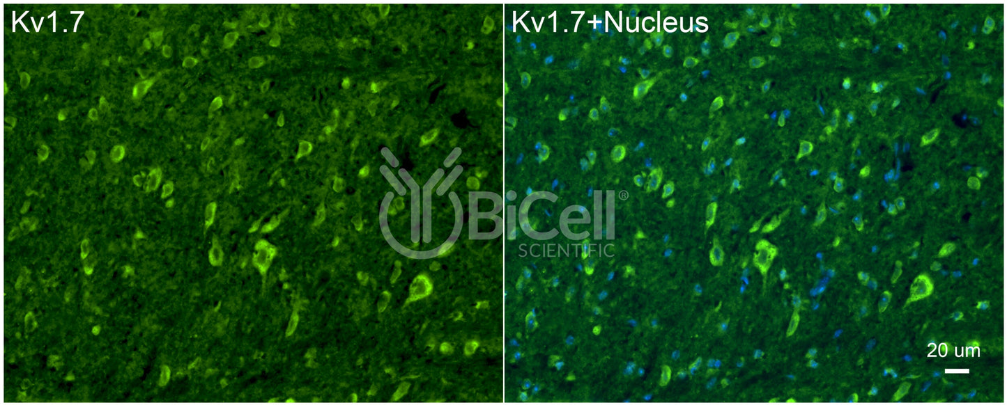 KCNA7 (Kv1.7) Antibody