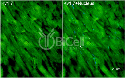 KCNA7 (Kv1.7) Antibody - FFPE Validated