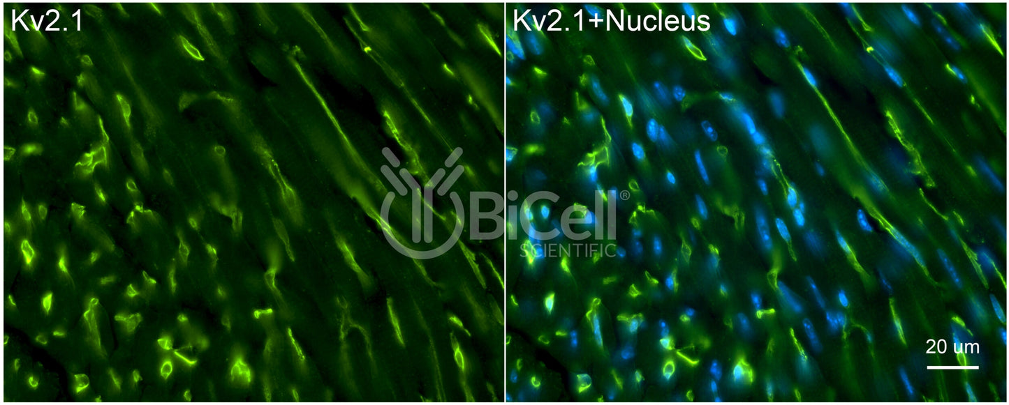 KCNB1 (Kv2.1) Antibody