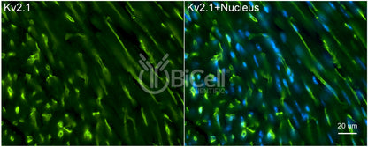 KCNB1 (Kv2.1) Antibody