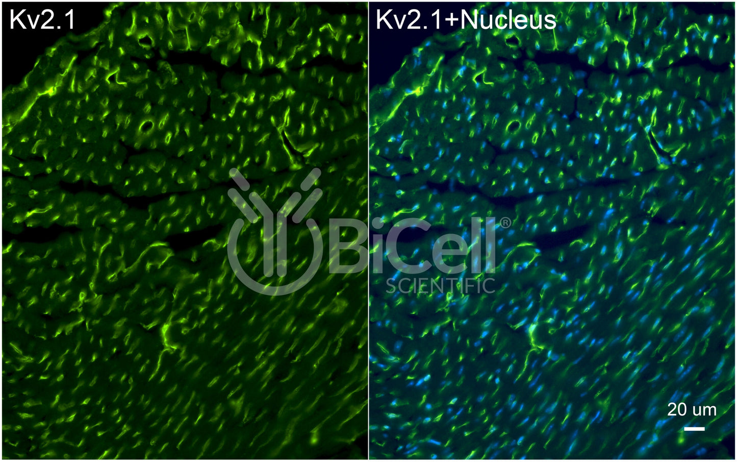 KCNB1 (Kv2.1) Antibody - Western Blot Validated