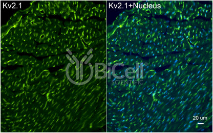 KCNB1 (Kv2.1) Antibody - Western Blot Validated