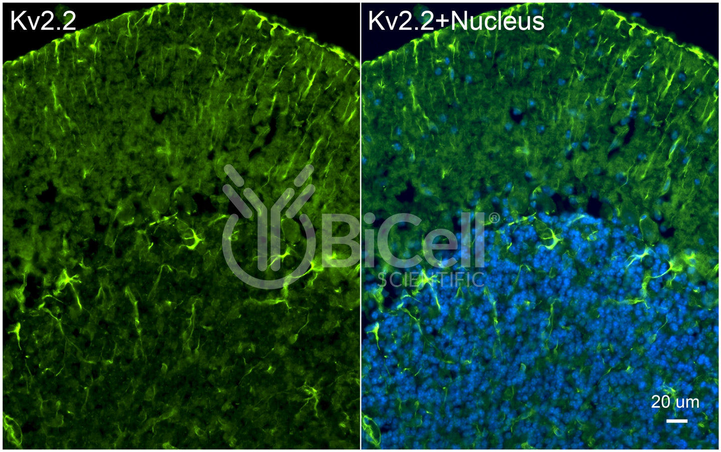 KCNB2 (Kv2.2) Antibody